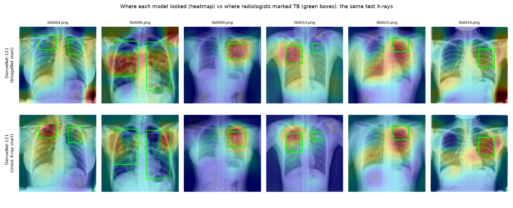 Heatmaps of the deployed model on TB test X-rays, with doctors' TB boxes in green
