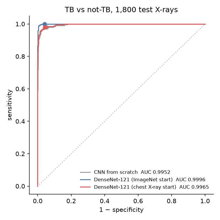 ROC curves for TB vs not-TB, three models